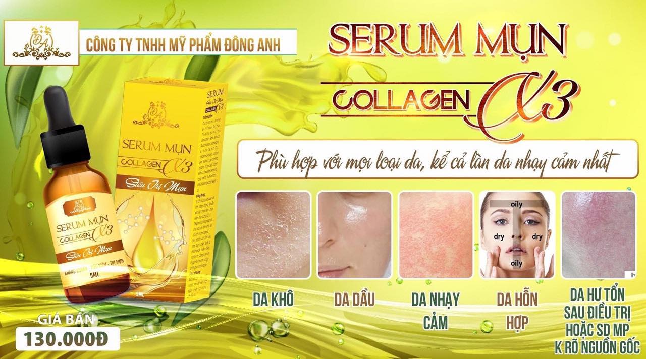 Serum trị mụn Đông Anh Collagen X3
