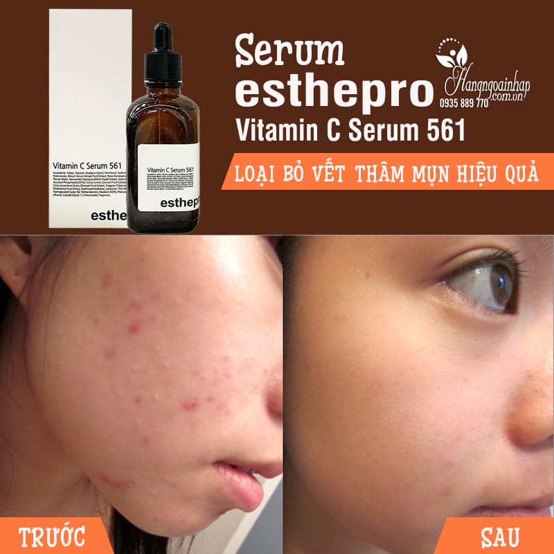 Serum dưỡng da EsthePro Vitamin C 561